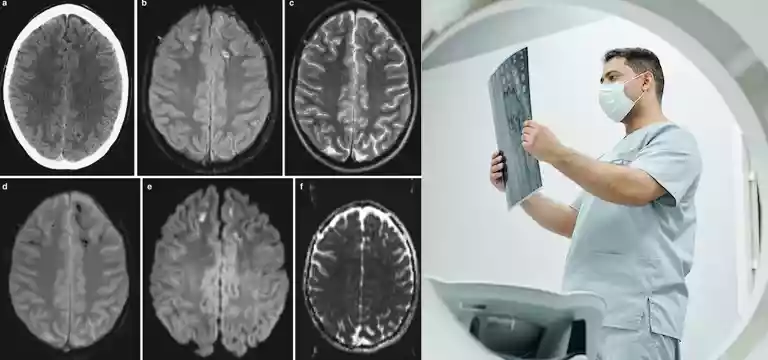 The Role of CT Scans in Assessing Traumatic Injuries: A Comprehensive Guide